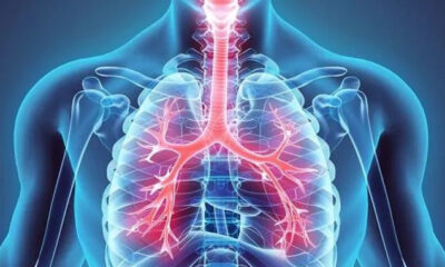 Sinsi hastalık vereme dikkat